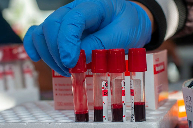 Indians and Egyptians involved in blood test fraud