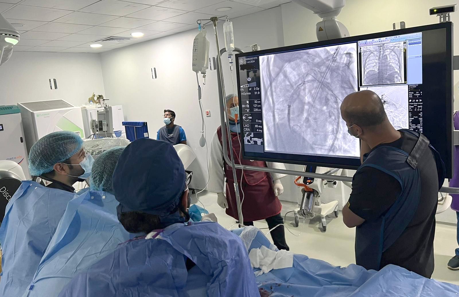 Mubarak Al-Kabeer Hospital makes history with the first Middle East surgery for aortic arch aneurysm